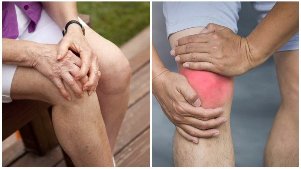 Symptome der Arthrose