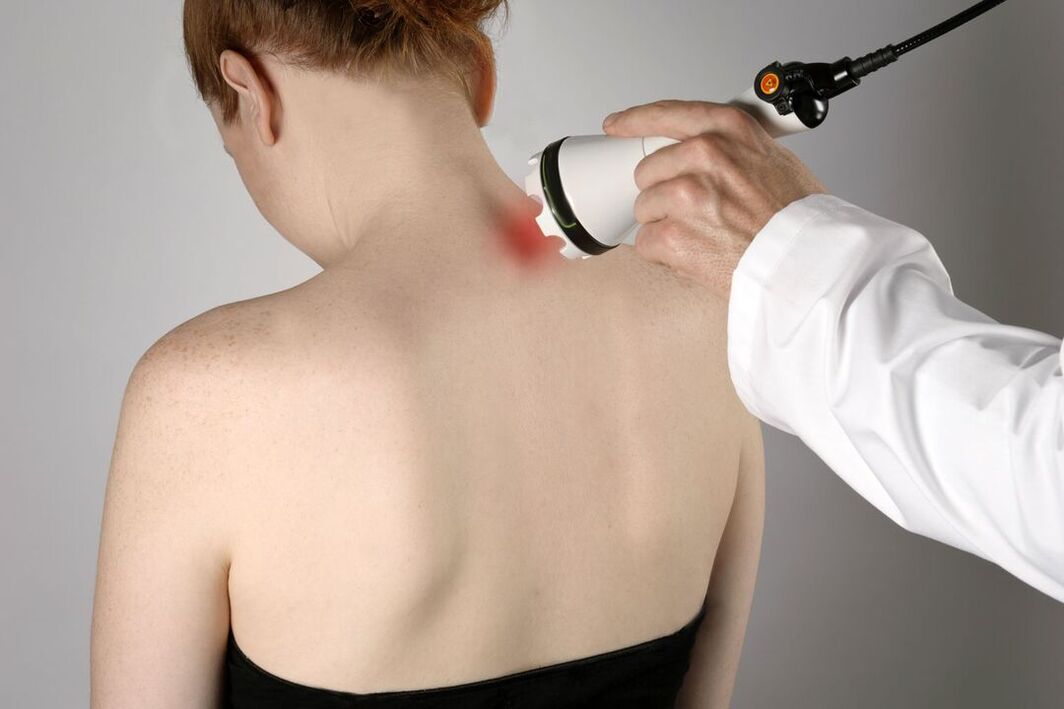 physiotherapeutische Behandlung der zervikalen Osteochondrose